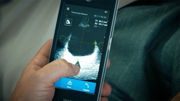 Vscan Extend Portable Ultrasound | GE Healthcare