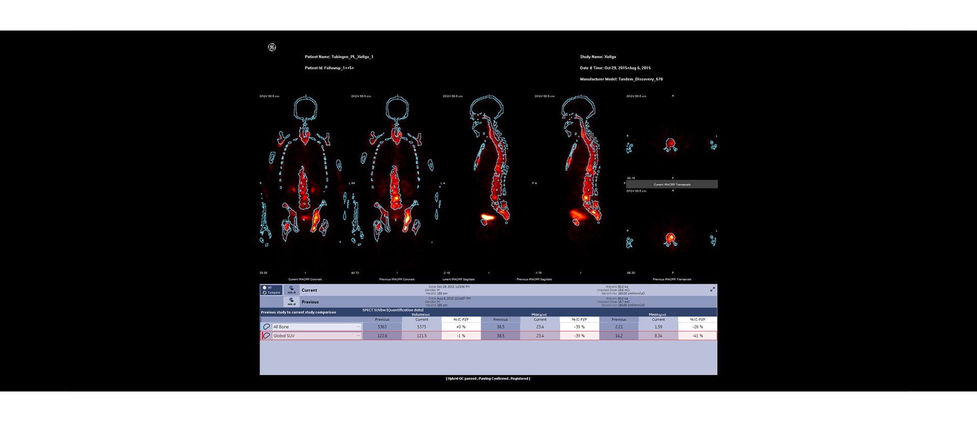 GEHCXeleris4DRQVolumetrixMIImage1v1