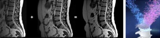 product-product-categories-magnetic-resonance-imaging-signa artist-digital_imaging.jpg