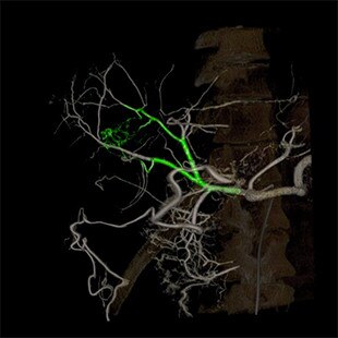 product-product-categories-Intervantional - 2016-flight_11.jpg