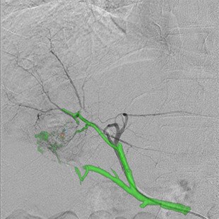 product-product-categories-Intervantional - 2016-flight_12.jpg